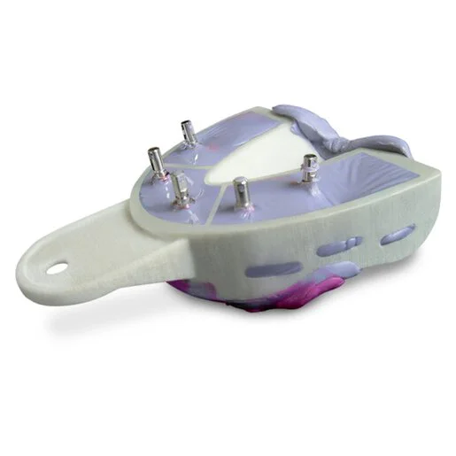 MiraTray Implant Advanced