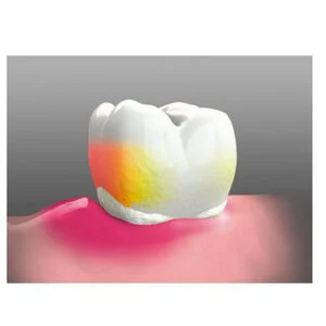 SOPROCARE