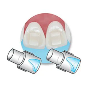 Mini-Mold Bite-Ramp Tips